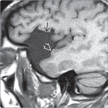 Ví dụ ảnh sagittal T1-weighted