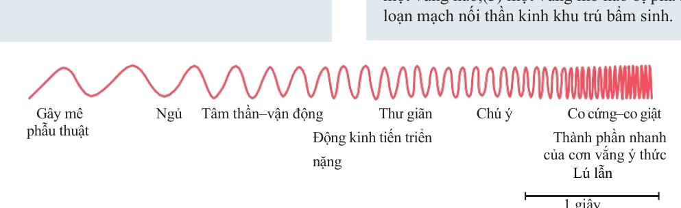Mức đồng bộ EEG thay đổi theo trạng thái hoạt động