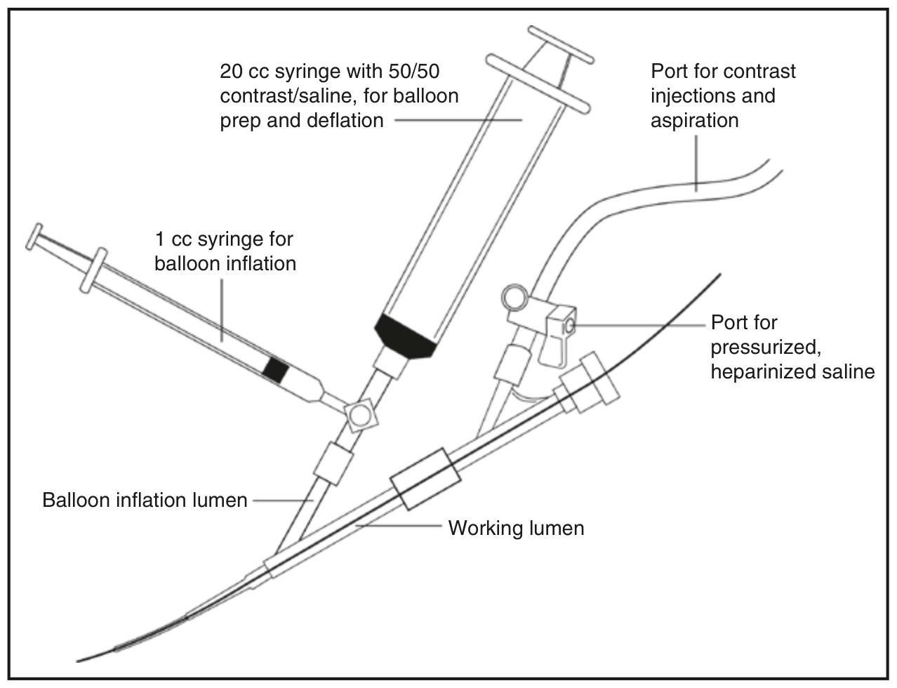 Các cổng và van của một hệ balloon-guide