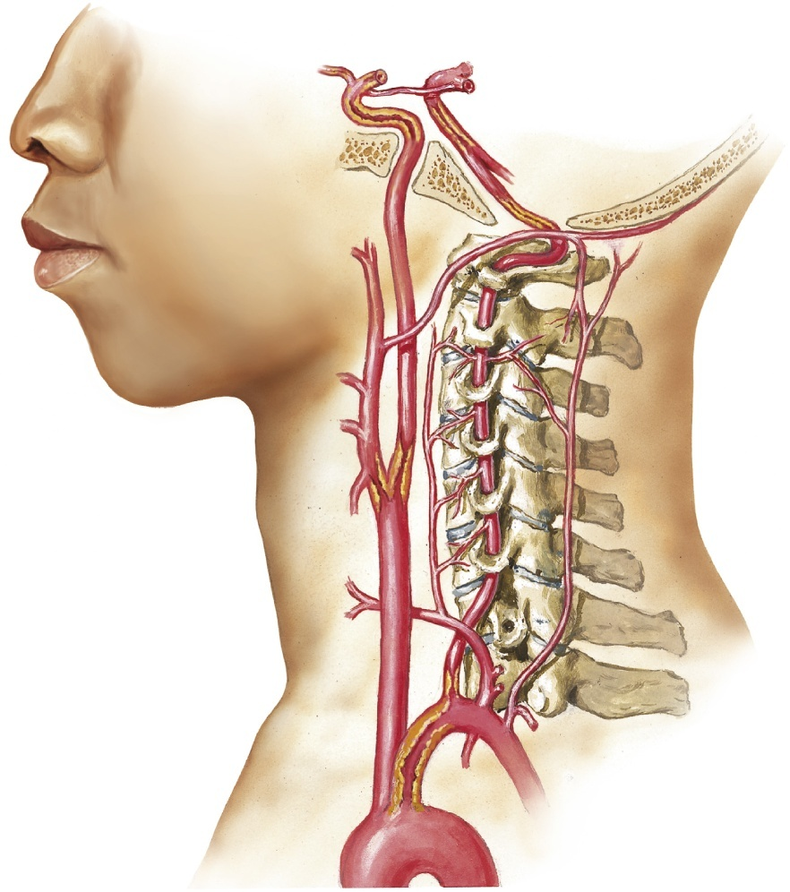 Đường động mạch cổ lên nền sọ