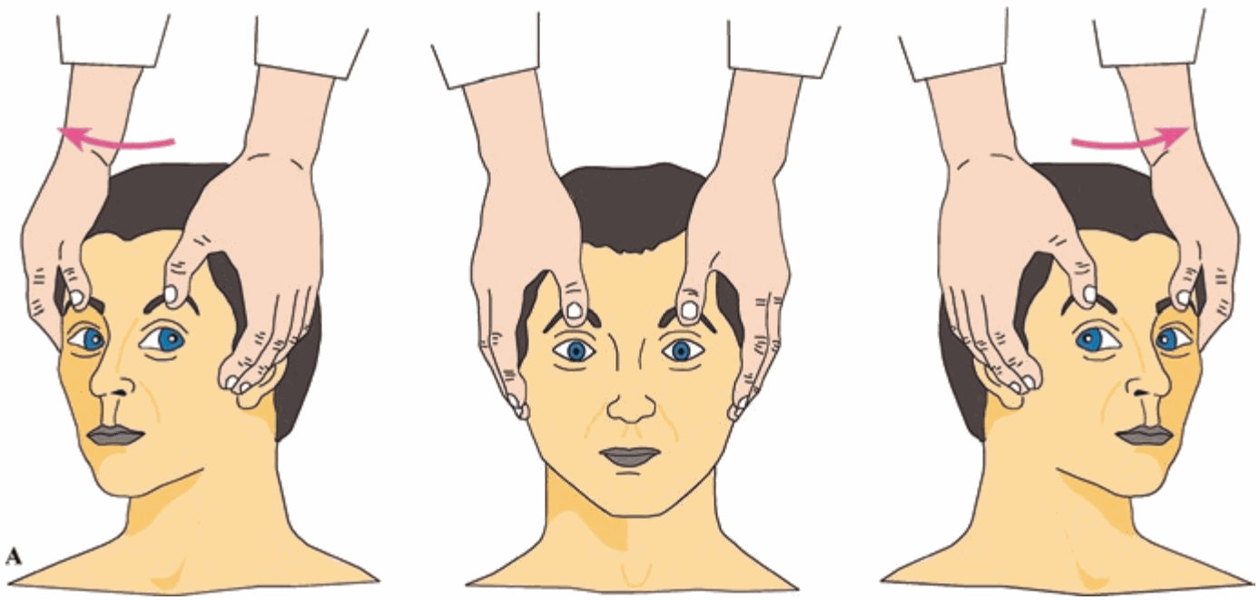 Nghiệm pháp head impulse đánh giá phản xạ tiền đình–mắt