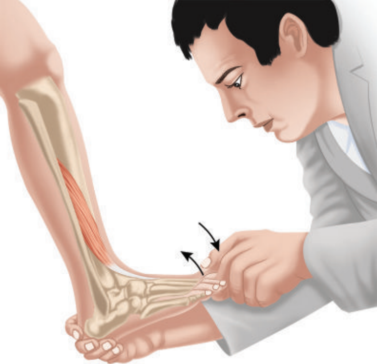 Khám cơ duỗi dài ngón cái ưu thế rễ L5