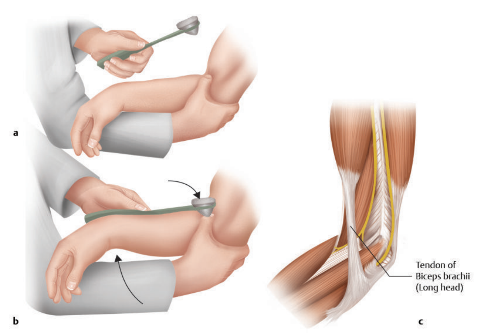 Khám phản xạ nhị đầu