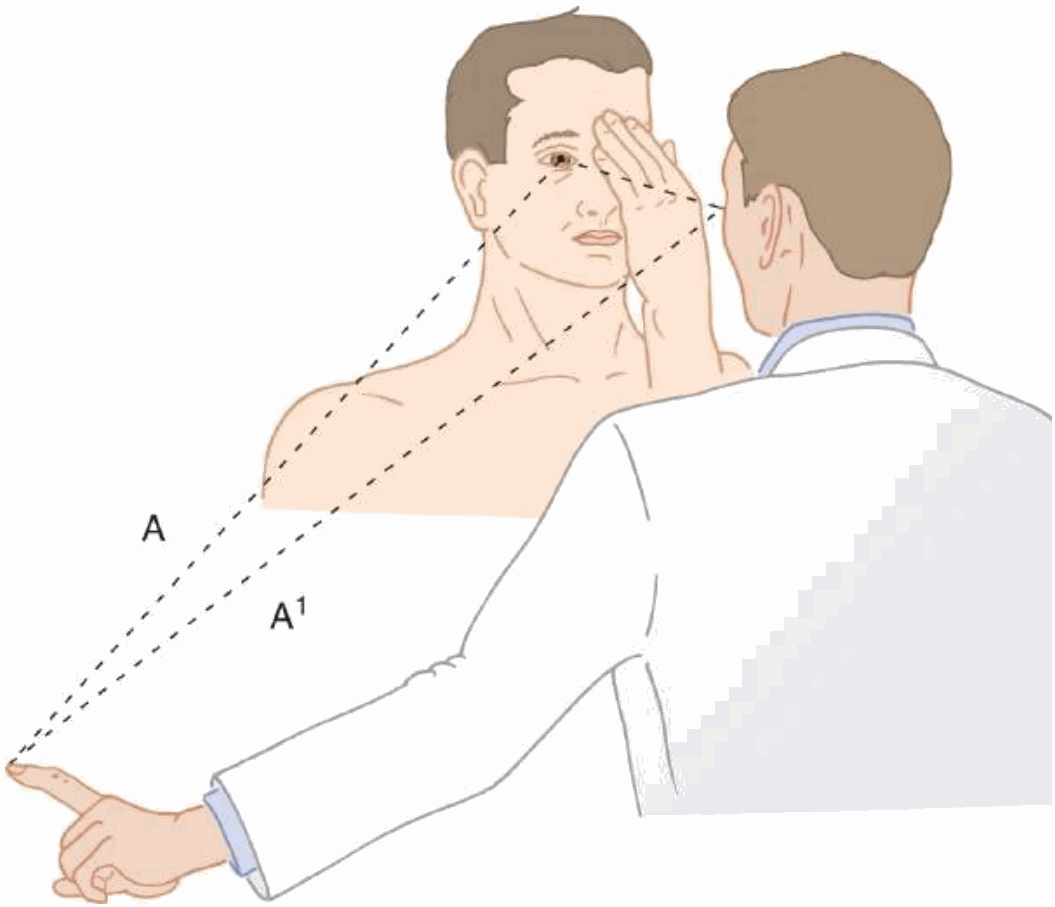 Khám thị trường bằng đối chiếu