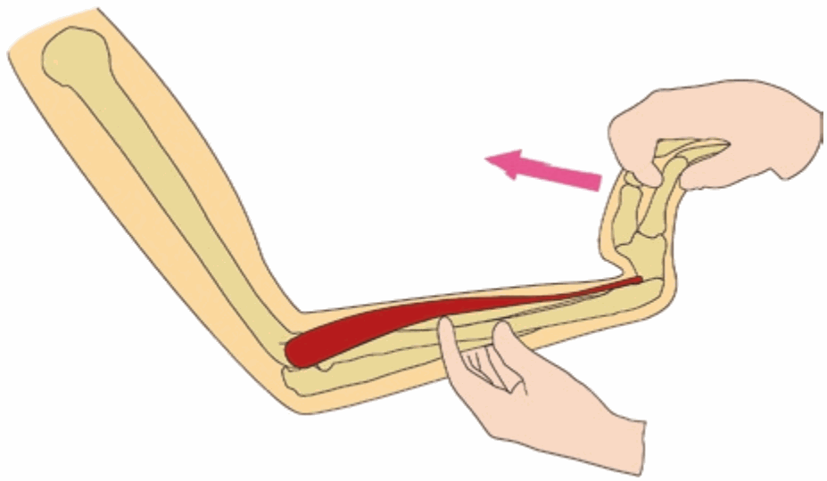 Khám duỗi cổ tay