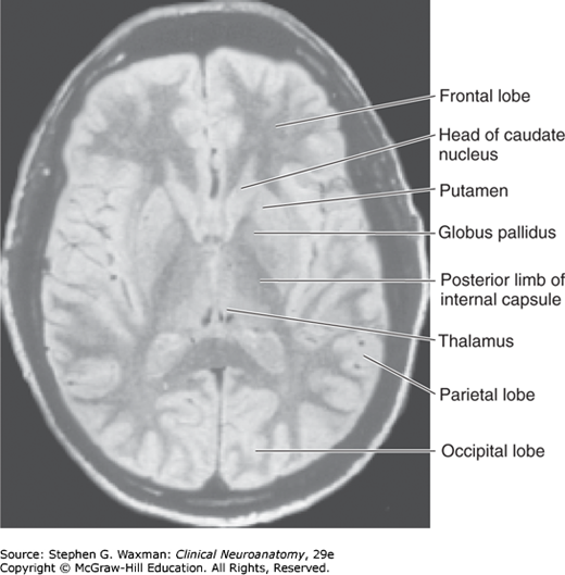 MRI cắt ngang mức hạch nền có nhãn: đầu nhân đuôi, nhân bèo, cầu nhạt, đùi sau bao trong, đồi thị