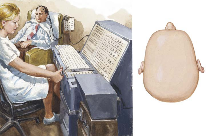 Tranh minh họa kỹ thuật viên ghi điện não trên bệnh nhân và sơ đồ vị trí điện cực trên hộp sọ