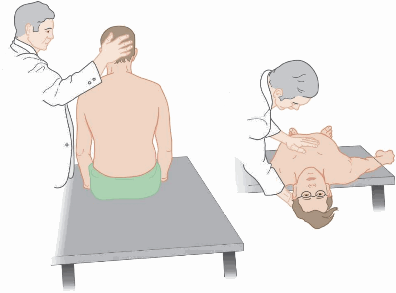 Nghiệm pháp Dix-Hallpike: bệnh nhân ngồi, đầu được xoay sang bên, rồi đưa nhanh về nằm ngửa với đầu thõng thấp hơn mặt bàn